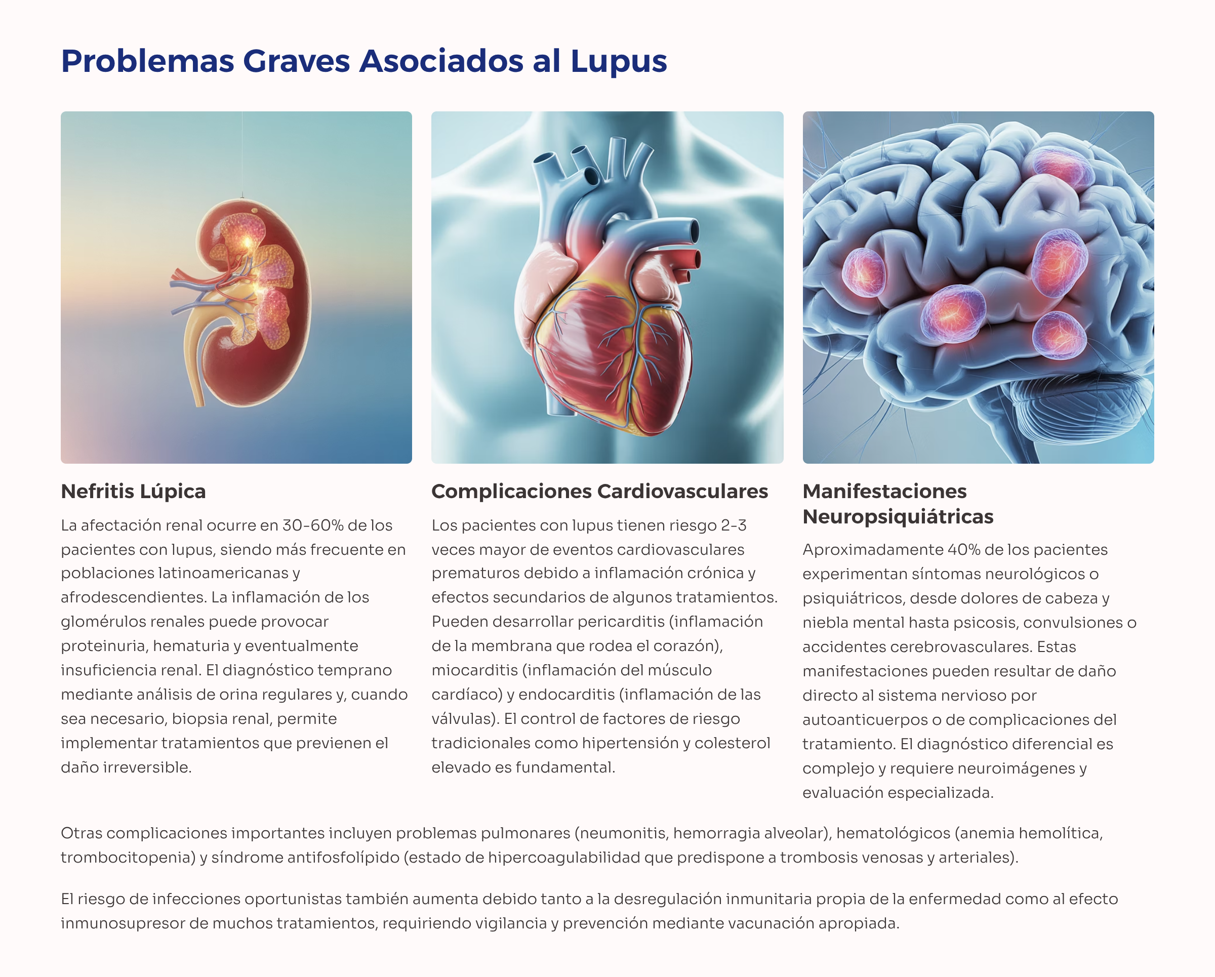 27_Problemas-Graves-Asociados-al-Lupus