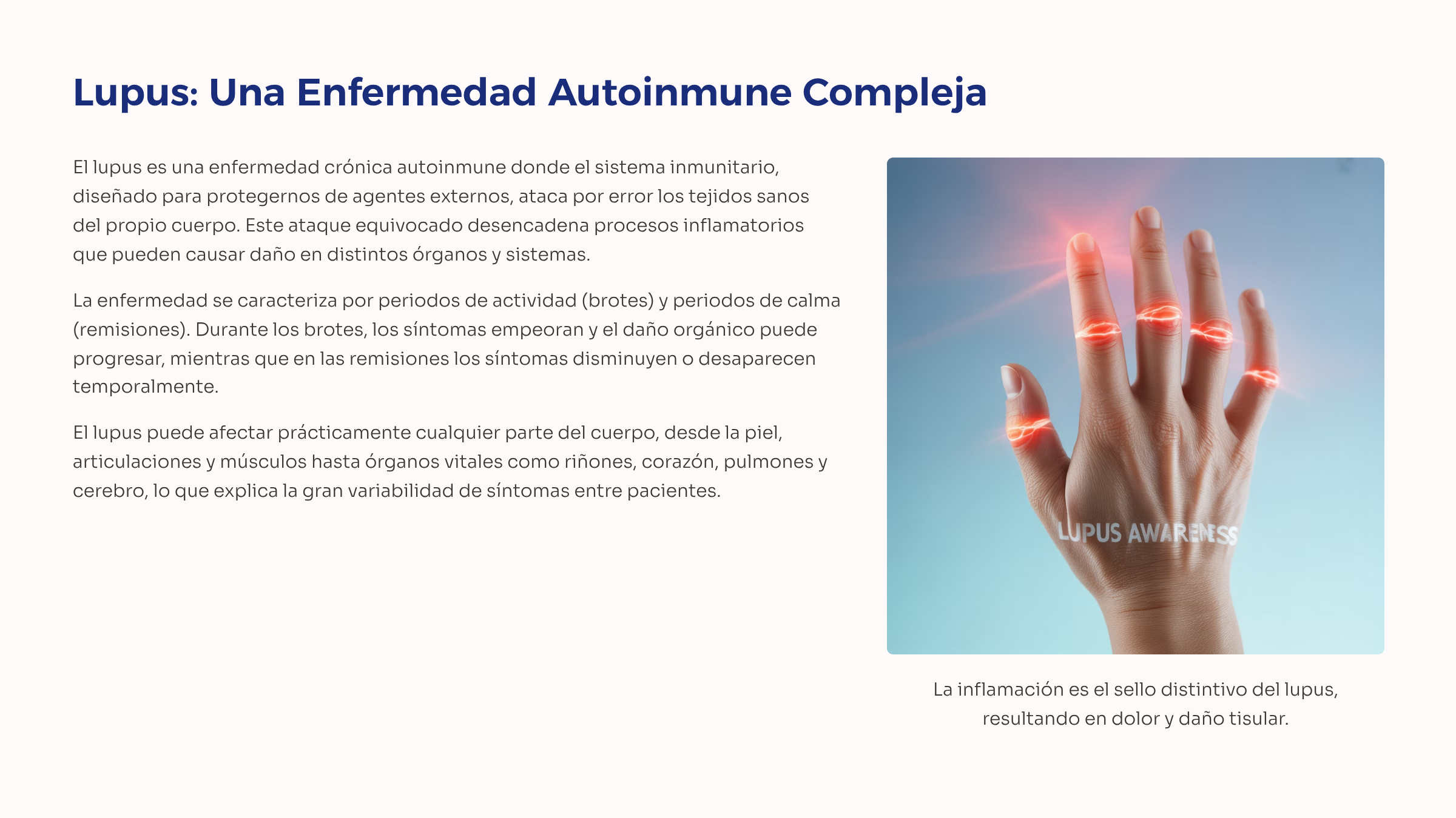 3_Lupus-Una-Enfermedad-Autoinmune-Compleja