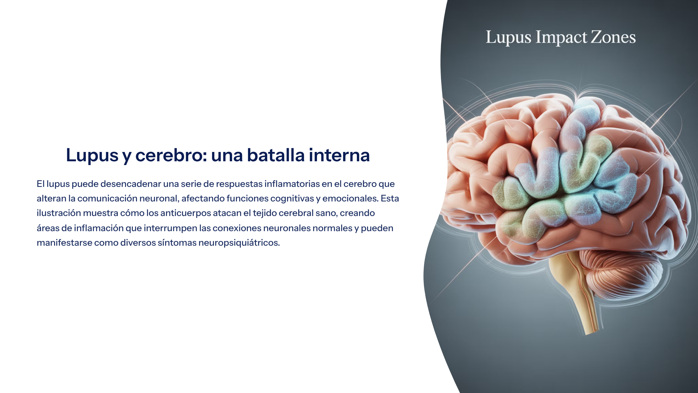 4_Lupus-y-cerebro-una-batalla-interna